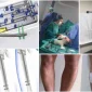 Bacak Uzatma Ameliyatı Maliyeti -Leg Lengthening Surgery Cost